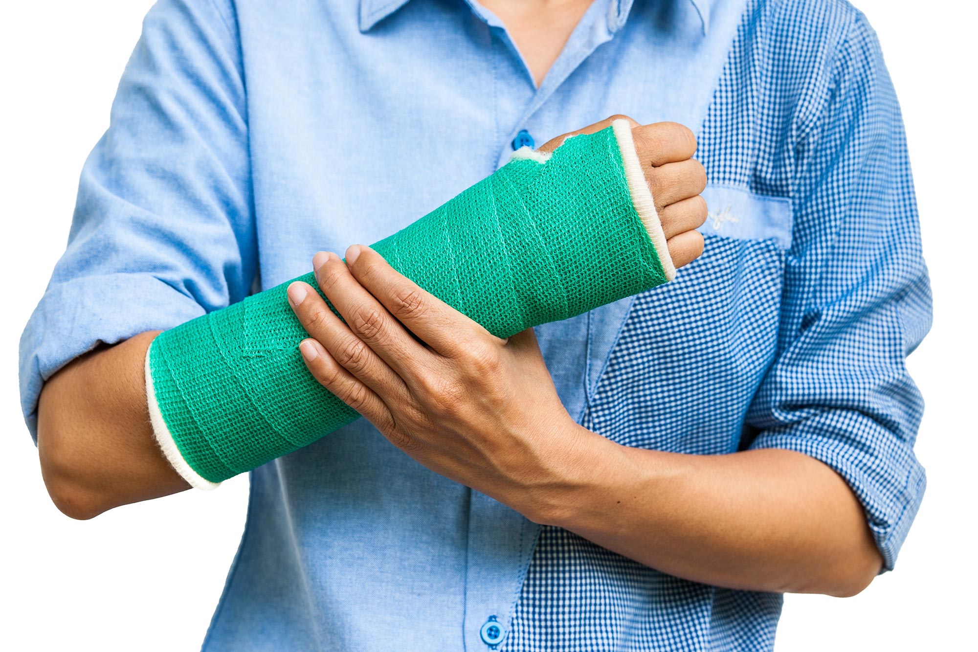 Brilliant Tips About How To Repair Broken Bones - Waterask